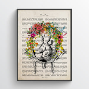 Twin Fetuses in Womb Flower Anatomy Print